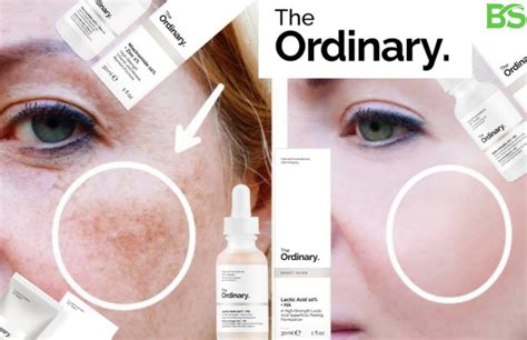 skincare for hypergimentation